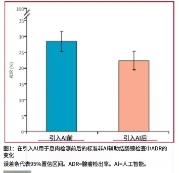 iQOO 16搭载自研电竞芯片Q4：行业首发光追+2K+165FPS三视效并发